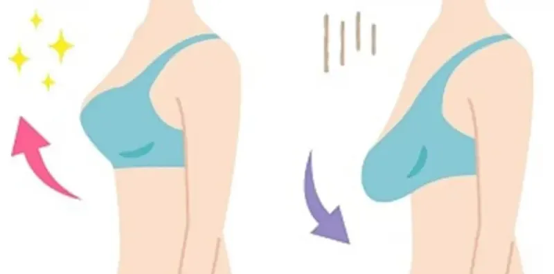تفاوت الگوهای برش پوست در 2 عمل ماموپلاستی و لیفت سینه