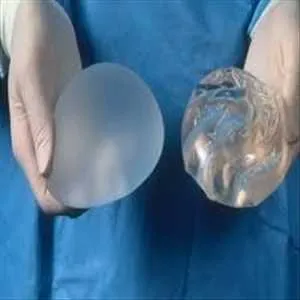 جراحی تعویض پروتز سینه یا برداشتن ایمپلنت سینه