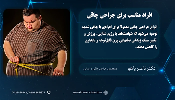 افراد مناسب برای جراحی چاقی