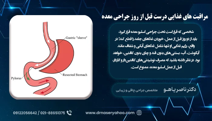 مراقبت‌ های غذایی درست قبل از روز جراحی معده