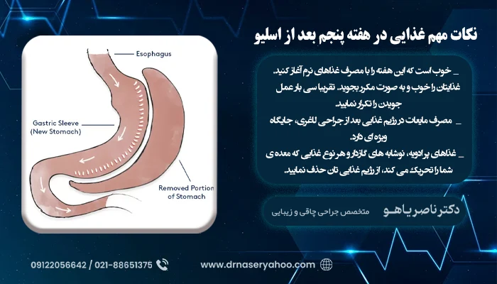 نکات مهم رژیم غذایی بعد از اسلیو معده در هفته پنجم