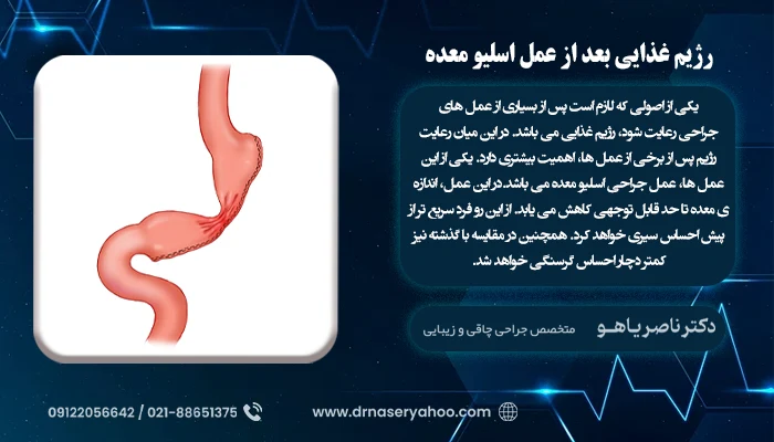 رژیم غذایی بعد از اسلیو معده