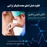 تفاوت عمل اسلیو معده با پیکر تراشی