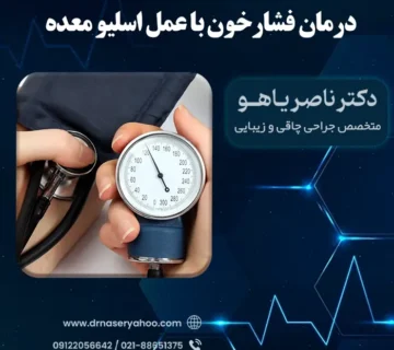 درمان فشارخون با عمل اسلیو معده