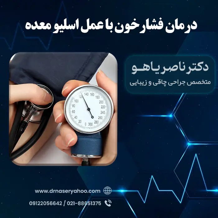 درمان فشارخون با عمل اسلیو معده