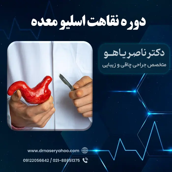 دوره نقاهت اسلیو معده