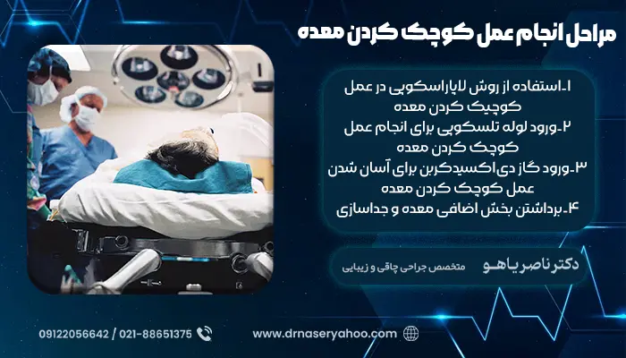 مراحل انجام عمل کوچک کردن معده