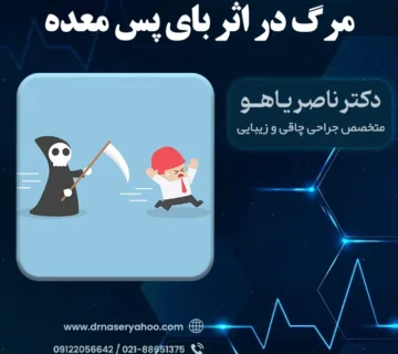 مرگ در اثر بای پس معده