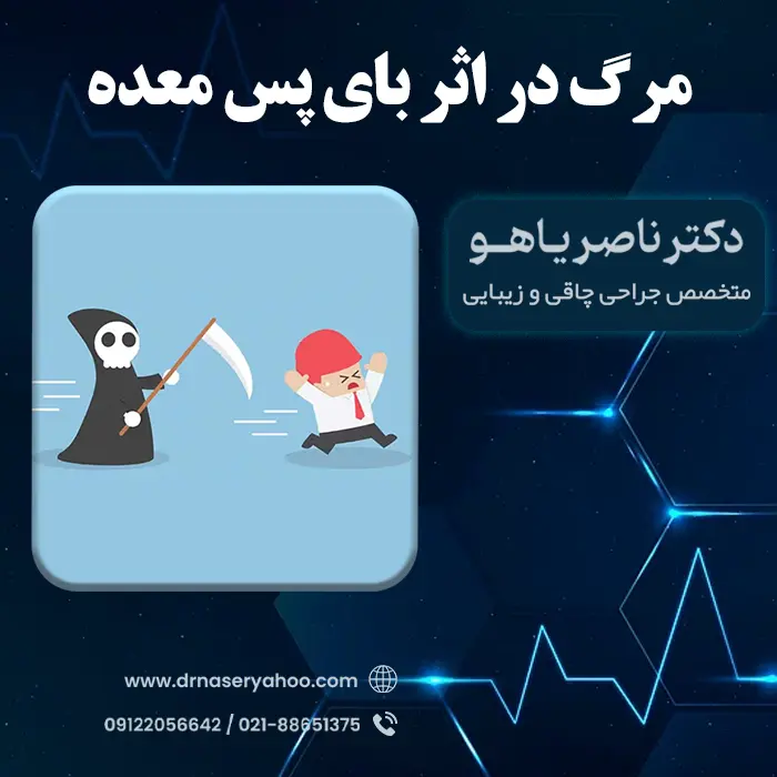 مرگ در اثر بای پس معده