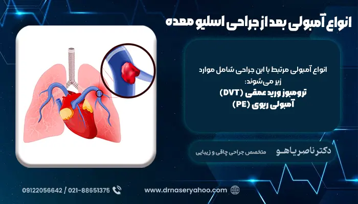 انواع آمبولی بعد از جراحی اسلیو معده