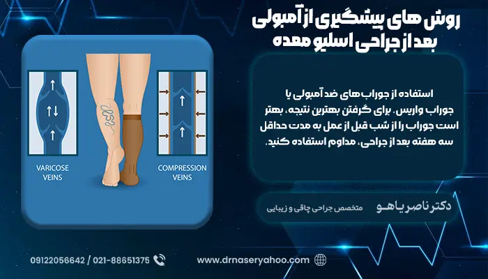 روش‌ های درمان آمبولی بعد از جراحی اسلیو معده