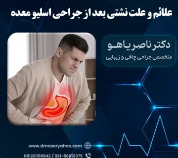 علائم و علت نشتی معده بعد از اسلیو معده