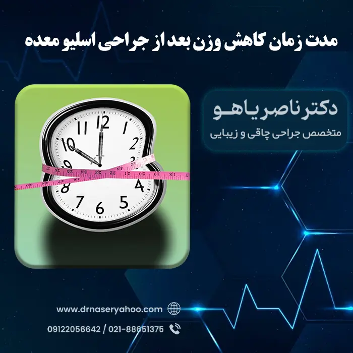 جدول کاهش وزن بعد از عمل اسلیو معده