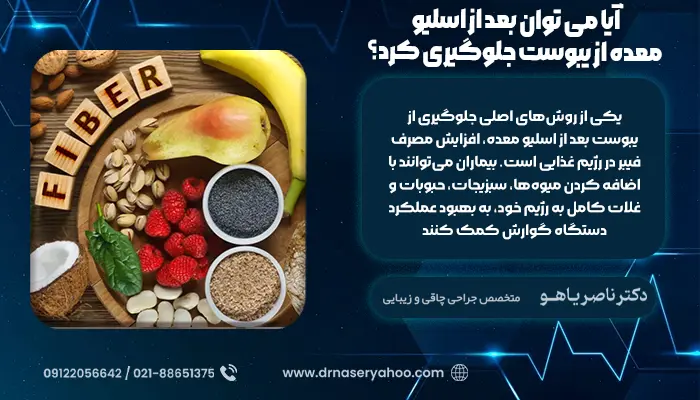 آیا می توان بعد از اسلیو معده از یبوست جلوگیری کرد؟
