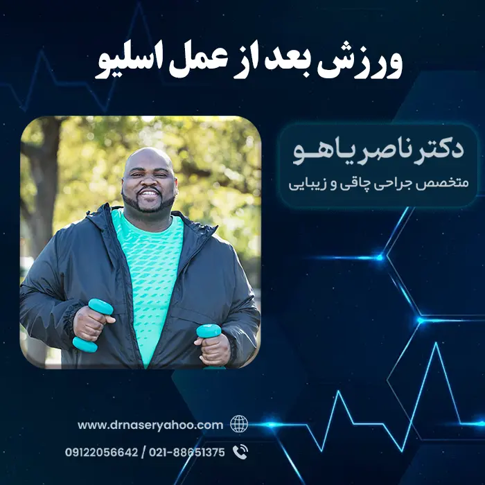 ورزش بعد از عمل اسلیو معده