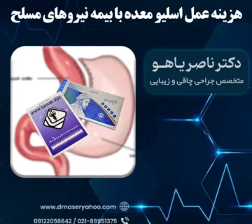 هزینه عمل اسلیو معده با بیمه نیروهای مسلح