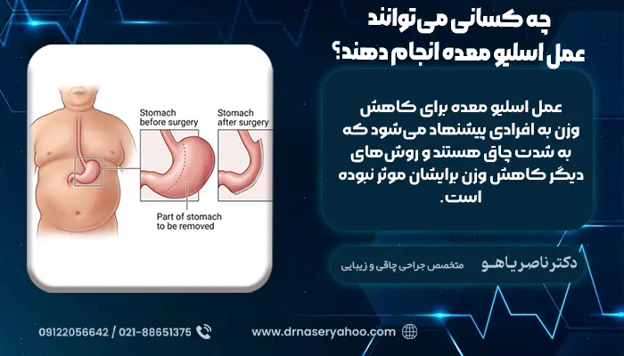 چه کسانی می‌توانند عمل اسلیو معده انجام دهند؟