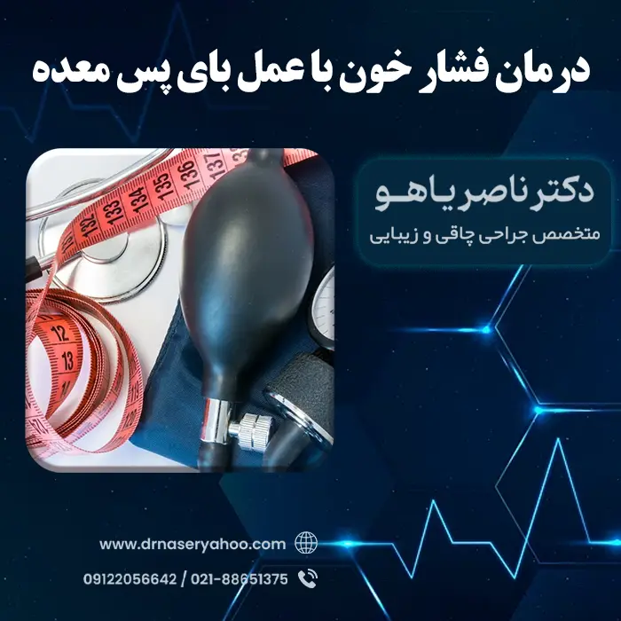 درمان فشار خون با عمل بای پس معده