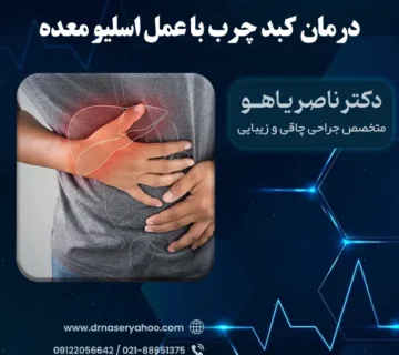 درمان کبد چرب با جراحی لاغری