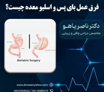 فرق بای پس و اسلیو