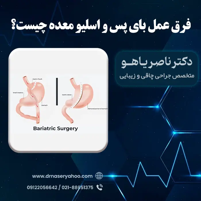 فرق بای پس و اسلیو