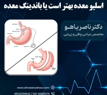 اسلیو معده بهتر است یا باندینگ معده