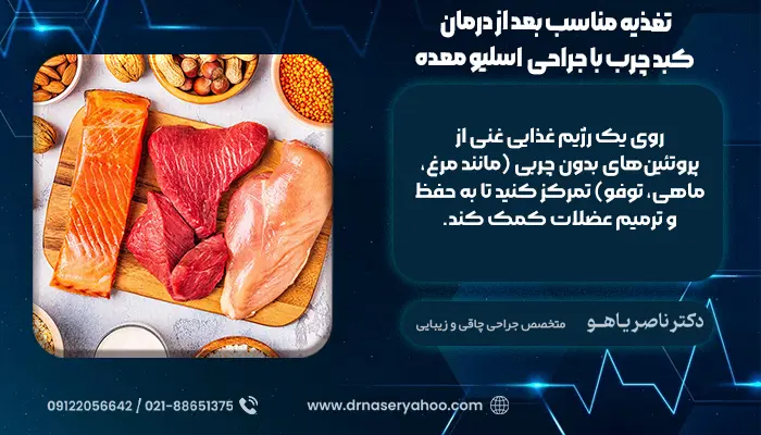 تغذیه مناسب بعد از درمان کبد چرب با جراحی  اسلیو معده