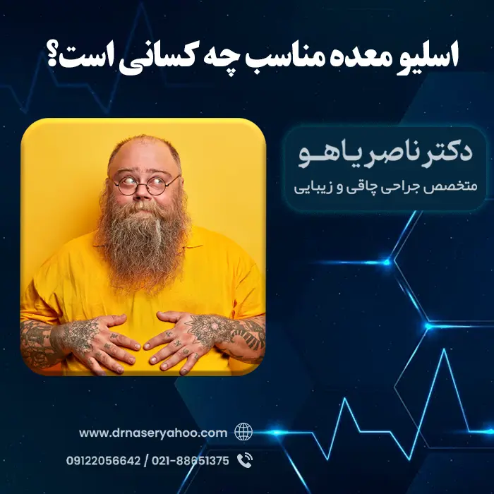 اسلیو معده برای چه وزنی مناسب است؟