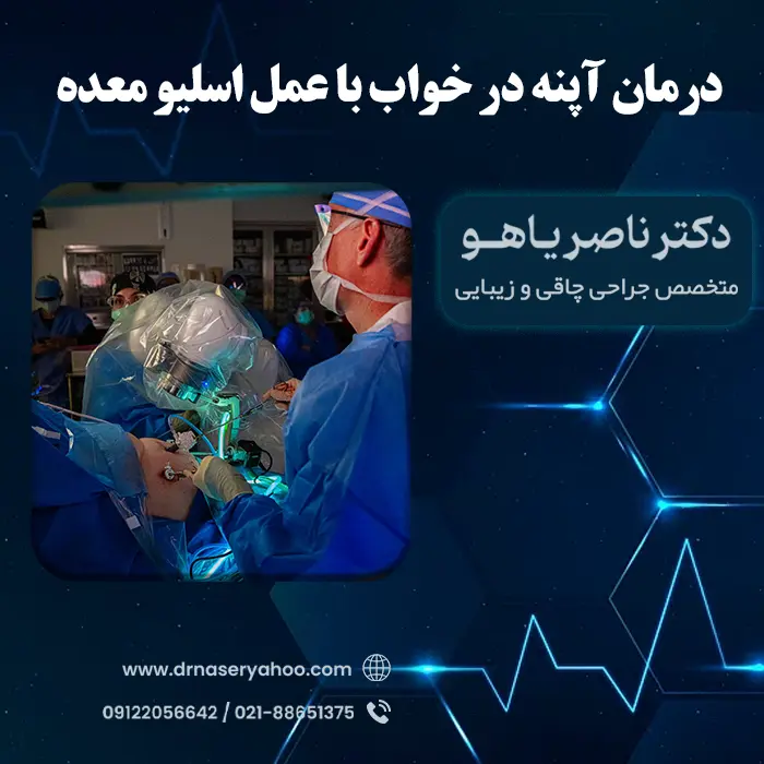 درمان آپنه در خواب با عمل اسلیو معده