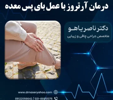 درمان آرتروز با عمل بای پس معده