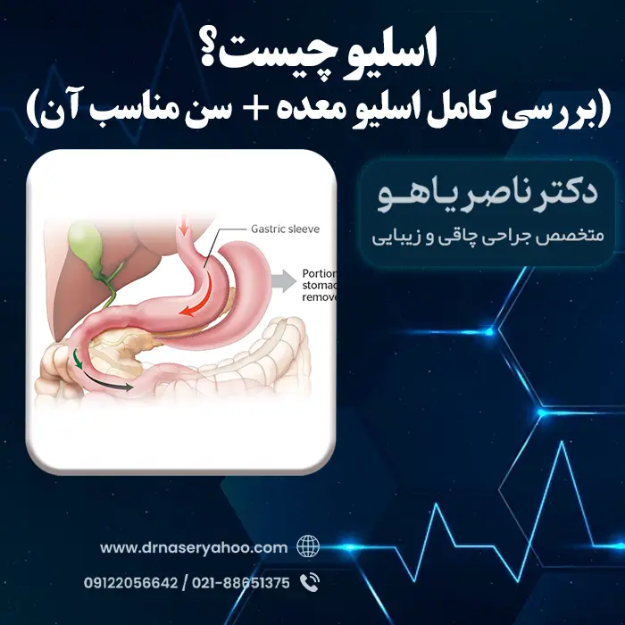 اسلیو چیست؟ بررسی کامل اسلیو معده + سن مناسب آن