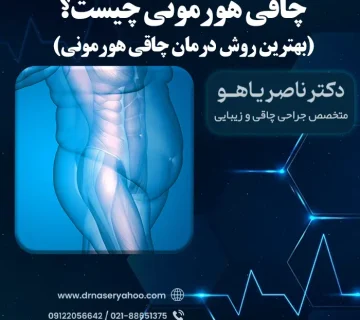 چاقی هورمونی چیست؟ بهترین روش درمان چاقی هورمونی