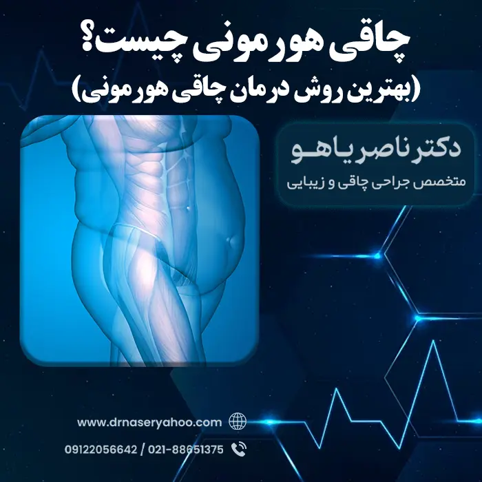 چاقی هورمونی چیست؟ بهترین روش درمان چاقی هورمونی