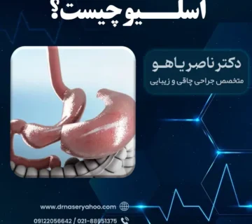 معنی اسلیو چیست؟ بررسی کامل اسلیو معده
