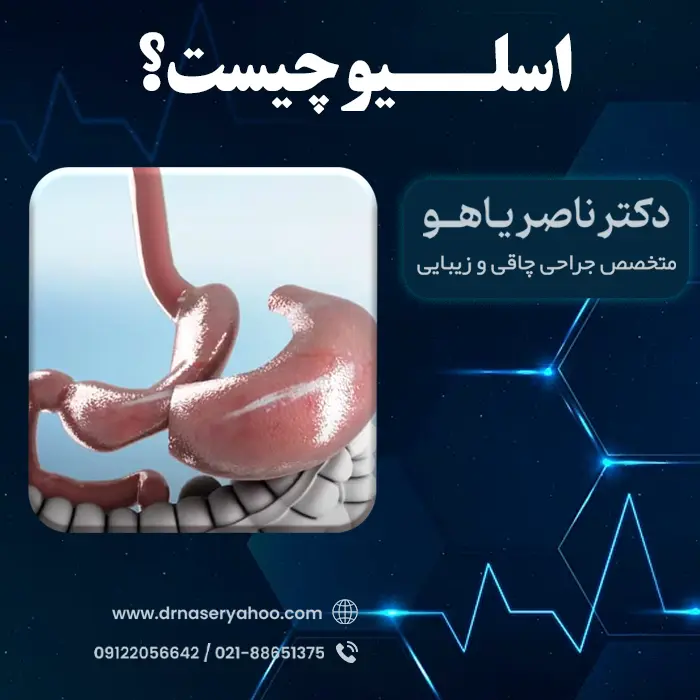 معنی اسلیو چیست؟ بررسی کامل اسلیو معده