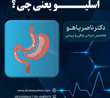 اسلیو معده یعنی چه؟
