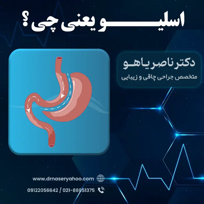 اسلیو معده یعنی چه؟