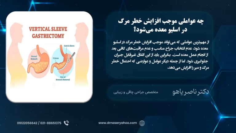 چه عواملی موجب افزایش خطر مرگ با عمل اسلیو معده می‌شود؟