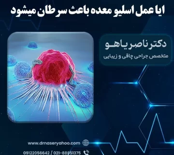 ایا عمل اسلیو معده باعث سرطان میشود