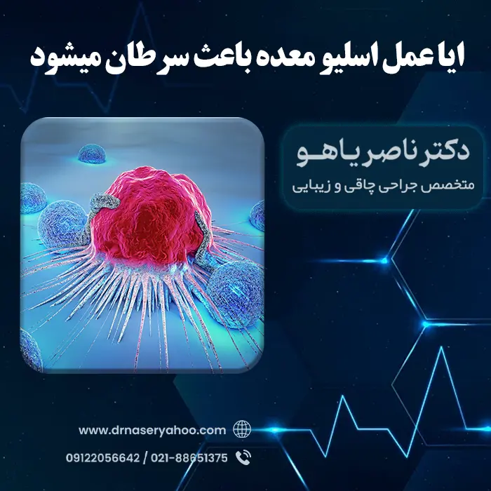ایا عمل اسلیو معده باعث سرطان میشود