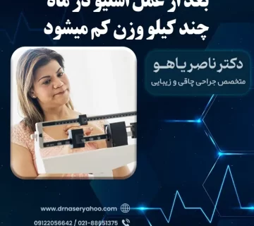 بعد از عمل اسلیو در ماه چند کیلو وزن کم میشود
