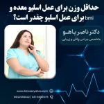 حداقل وزن برای عمل اسلیو معده + محاسبه bmi برای عمل اسلیو