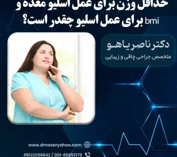حداقل وزن برای عمل اسلیو معده + محاسبه bmi برای عمل اسلیو