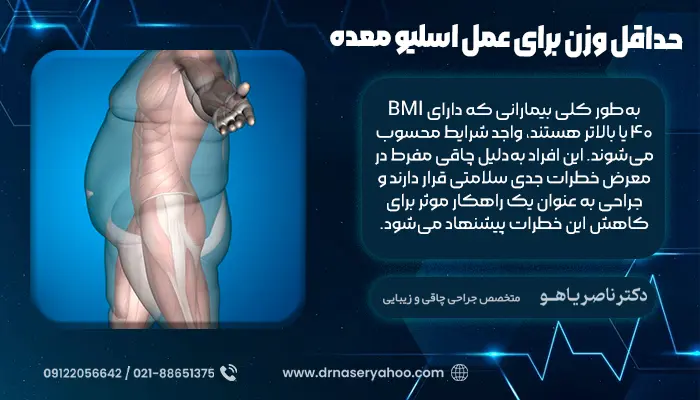 حداقل وزن برای عمل اسلیو معده