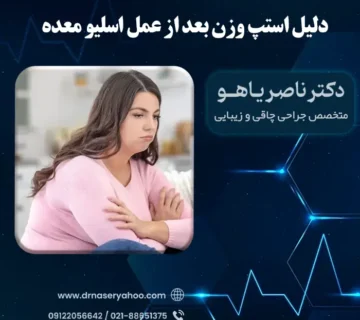 دلایل استپ وزن بعد از عمل اسلیو معده