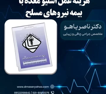 هزینه عمل اسلیو معده با بیمه نیروهای مسلح