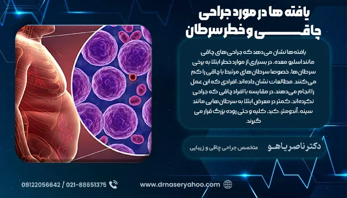 یافته ها در مورد جراحی چاقی و خطر سرطان