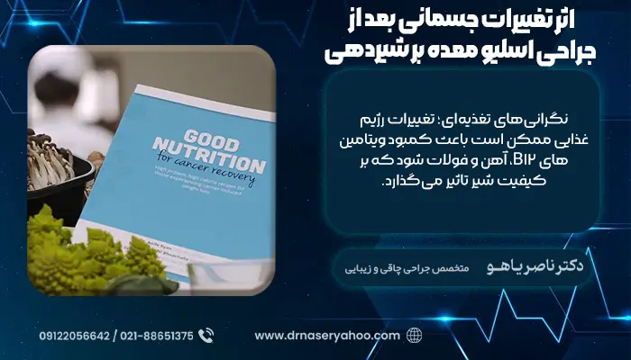 اثر تغییرات جسمانی بعد از جراحی اسلیو معده بر شیردهی