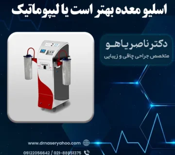 اسلیو معده بهتر است یا لیپوماتیک