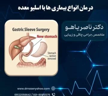 درمان بیماری‌ ها با اسلیو معده